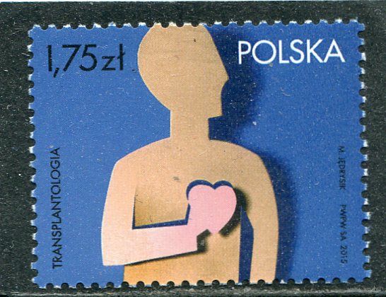 Польша. Медицина. Транспланталогия